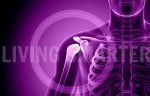 Clavicle Shoulder Pain